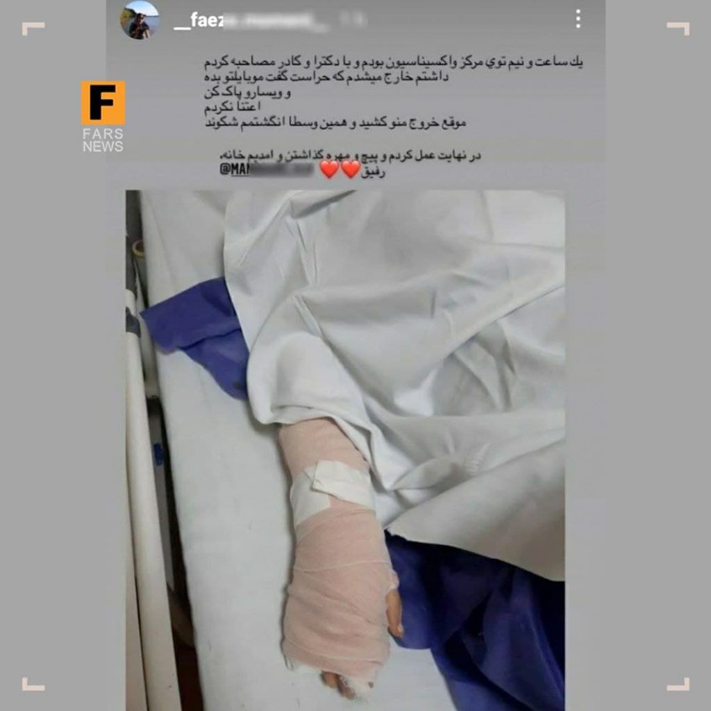 شکستن دست خبرنگار خانم در دانشگاه پزشکی شهید بهشتی