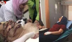 عیادت وزیر اطلاع‌رسانی و هیئت رسانه‌ای سوری از خبرنگار و تصویربردار مجروح العالم
